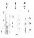 Fig. 58 - Devices for detecting or filtering tumor cells