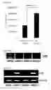 Fig. 03 - Methods for detecting an amount of complement factor B protein and carbohydrate antigen 19-9 protein, and methods for diagnosing and treating pancreatic cancer using the same