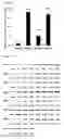 Fig. 04 - Methods for detecting an amount of complement factor B protein and carbohydrate antigen 19-9 protein, and methods for diagnosing and treating pancreatic cancer using the same