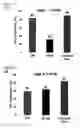 Fig. 09 - Methods for detecting an amount of complement factor B protein and carbohydrate antigen 19-9 protein, and methods for diagnosing and treating pancreatic cancer using the same