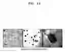 Fig. 02 - Composition, kit, and method for diagnosing and treating ovarian cancer