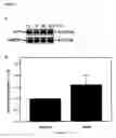 Fig. 10 - Methods and kits for detecting brain injury