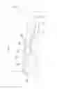 Fig. 10 - WHEEL SPEED SENSOR
