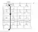 Fig. 01 - Fault isolation system and method for detecting faults in a circuit