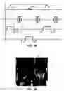 Fig. 04 - Phase-cycled steady-state free precession imaging