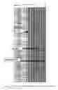 Fig. 02 - Advanced noise reduction in acoustic well logging