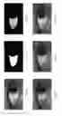 Fig. 09 - Feature extraction and matching for biometric authentication