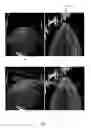 Fig. 07 - Adaptive selection of scale invariant image feature keypoints