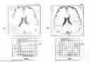 Fig. 01 - Image processing apparatus