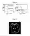 Fig. 08 - Image processing apparatus