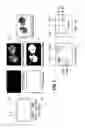 Fig. 04 - Image processing method and system for analyzing a multi-channel image obtained from a biological tissue sample being stained by multiple stains