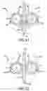 Fig. 09 - HIGH STRENGTH COMMUNICATIONS CABLE SEPARATOR