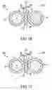 Fig. 12 - HIGH STRENGTH COMMUNICATIONS CABLE SEPARATOR
