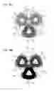 Fig. 11 - Multi-phase reactor capable of obtaining constant inductance for each phase