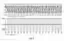 Fig. 06 - Reconfigurable coupled inductor