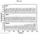 Fig. 05 - Liquid phenothiazine catholytes for non-aqueous redox flow batteries