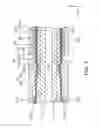 Fig. 04 - Fuel cell stack