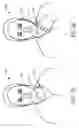 Fig. 10 - Integrated MEMS microphone and vibration sensor