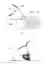 Fig. 08 - Gait Helper