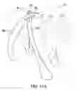 Fig. 08 - Stretchable animal foot covering