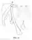 Fig. 11 - Stretchable animal foot covering