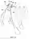 Fig. 16 - Stretchable animal foot covering