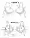Fig. 03 - Bra engineering