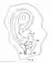 Fig. 01 - PROTECTIVE EARRING COVER