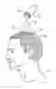 Fig. 01 - BALDING CONCEALEMENT METHOD AND APPARATUS
