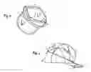 Fig. 03 - Original Fitted Cap Cover
