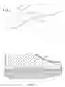 Fig. 02 - RIGID ORTHOTIC AND METHOD OF FORMING