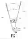 Fig. 02 - Compression stocking donning aid