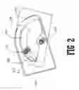 Fig. 03 - Compression stocking donning aid