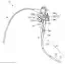 Fig. 01 - Holding mechanism and insertion device