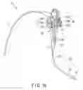 Fig. 02 - Holding mechanism and insertion device
