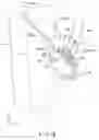 Fig. 03 - Holding mechanism and insertion device