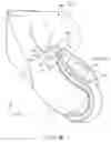 Fig. 11 - Holding mechanism and insertion device