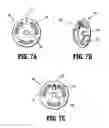 Fig. 07 - Laparoscopic visualization system