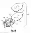 Fig. 10 - Laparoscopic visualization system