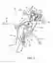 Fig. 02 - Surgical access system and related methods