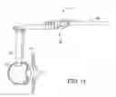 Fig. 15 - Surgical access system and related methods