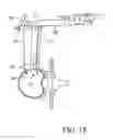 Fig. 19 - Surgical access system and related methods