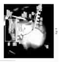 Fig. 07 - Location indicator for optical coherence tomography in ophthalmic visualization