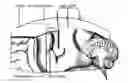 Fig. 01 - CRANIAL IMPLANTS FOR LASER IMAGING AND THERAPY