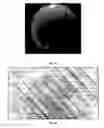 Fig. 05 - CRANIAL IMPLANTS FOR LASER IMAGING AND THERAPY