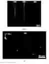Fig. 09 - CRANIAL IMPLANTS FOR LASER IMAGING AND THERAPY