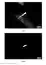 Fig. 10 - CRANIAL IMPLANTS FOR LASER IMAGING AND THERAPY