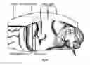 Fig. 12 - CRANIAL IMPLANTS FOR LASER IMAGING AND THERAPY