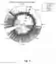 Fig. 04 - ECG clock electrocardiogram based diagnostic device and method