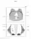 Fig. 06 - MEDICAL IMAGING APPARATUS AND METHOD OF PROCESSING MEDICAL IMAGE